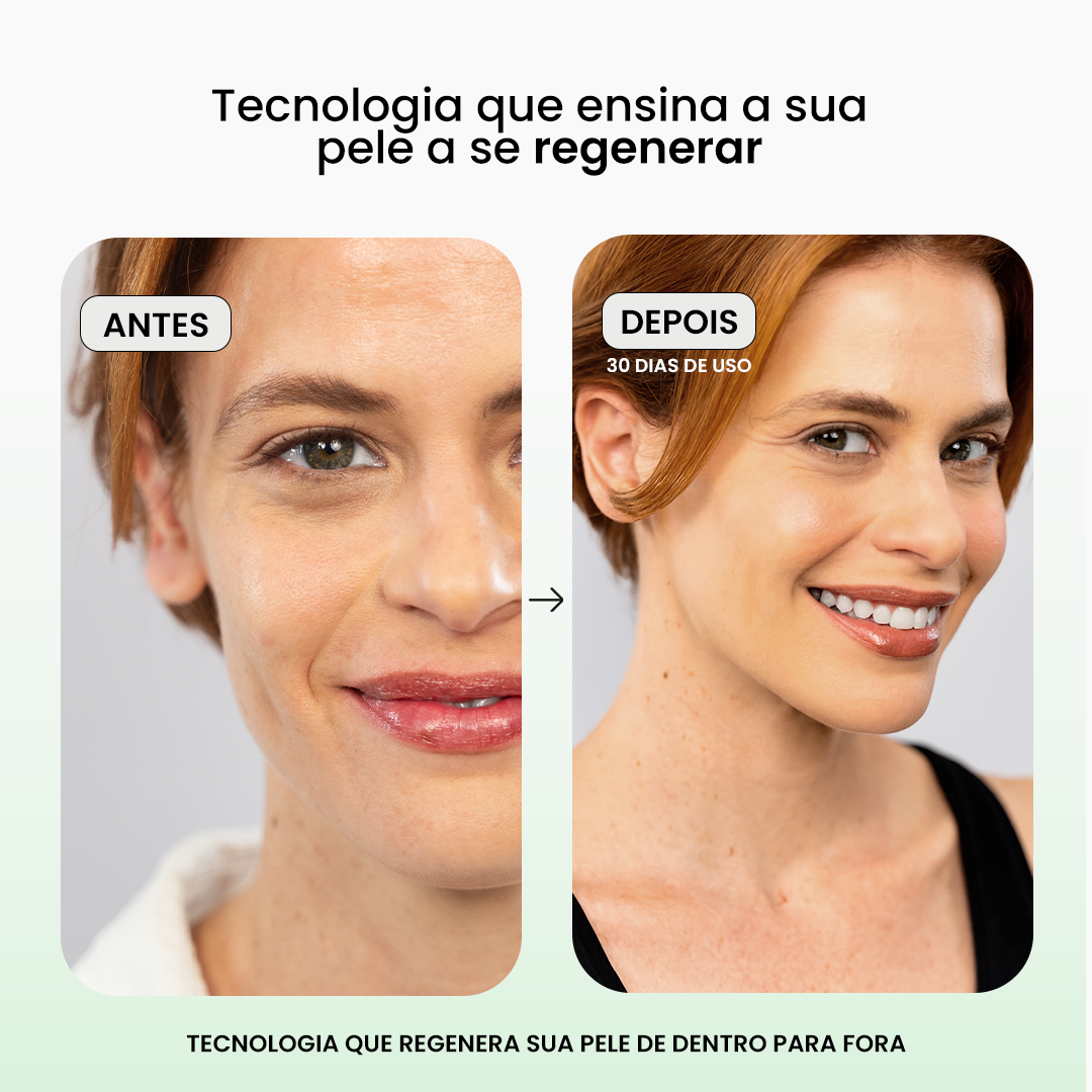 Pele de Porcelana