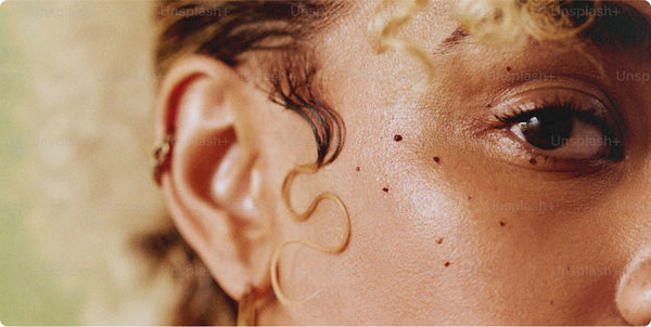 Cuidados com a Pele no Inverno - Como Prevenir a Pele Seca nesta Estação