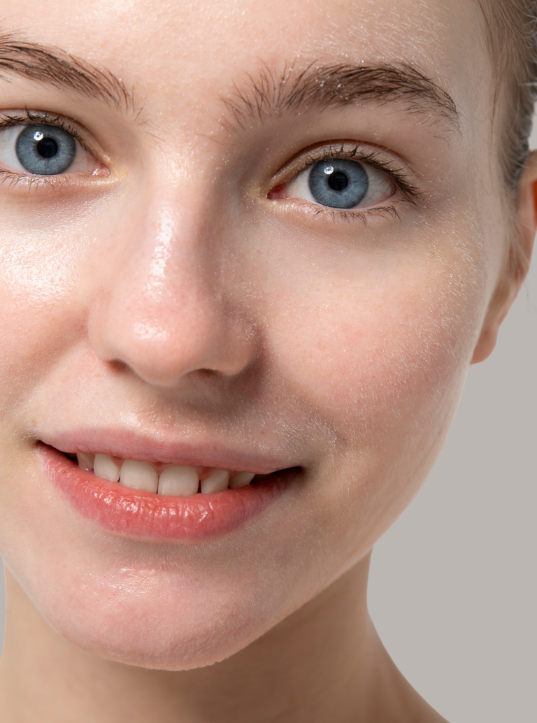 Barreira da Pele Comprometida