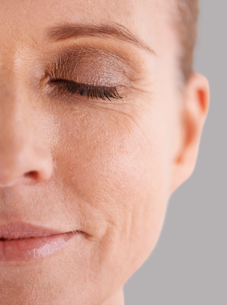 Pele Cansada e Sem Viço