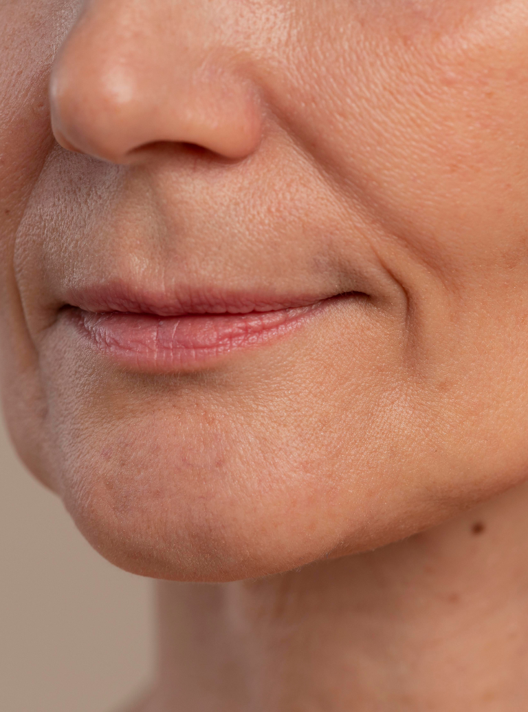 Perda de Definição no Rosto