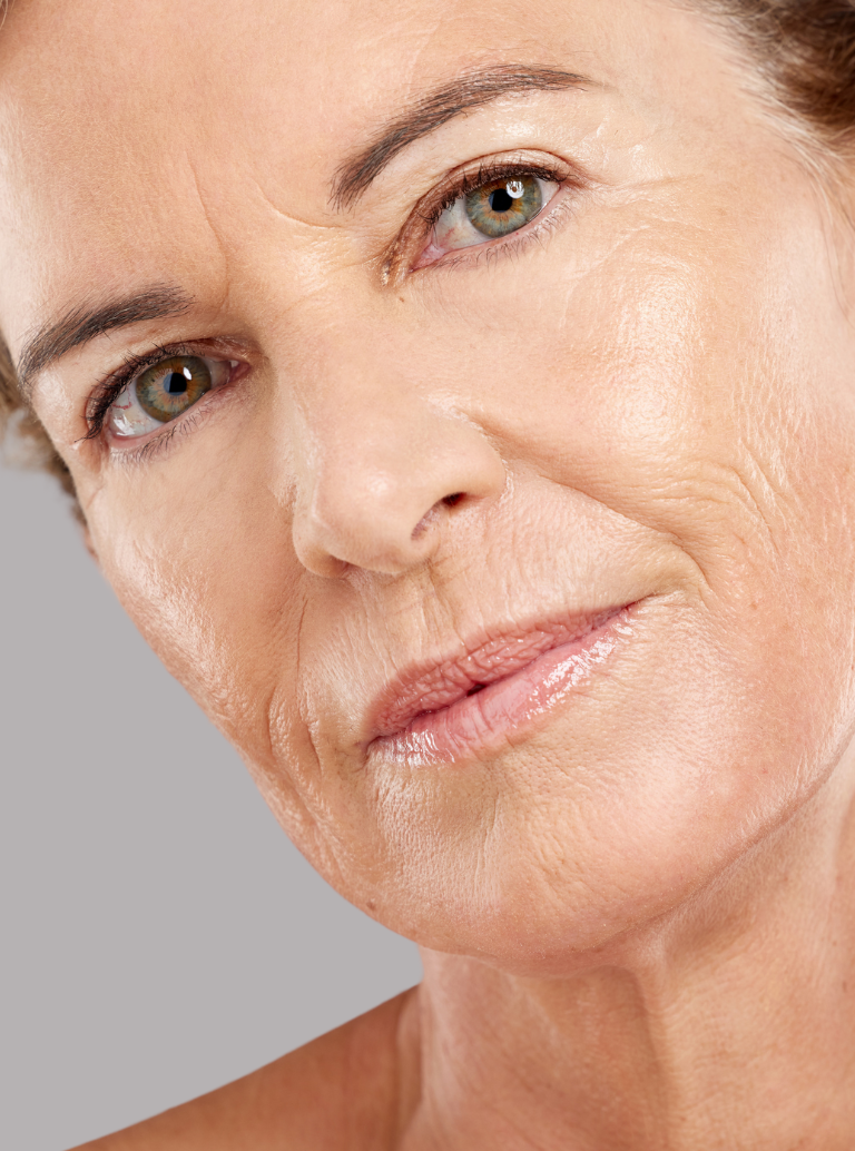 Linhas de Expressão