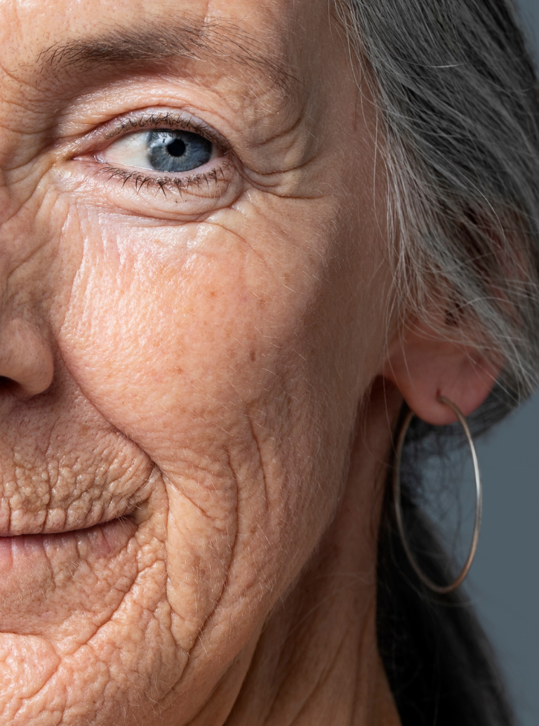 Falta de Firmeza e Densidade