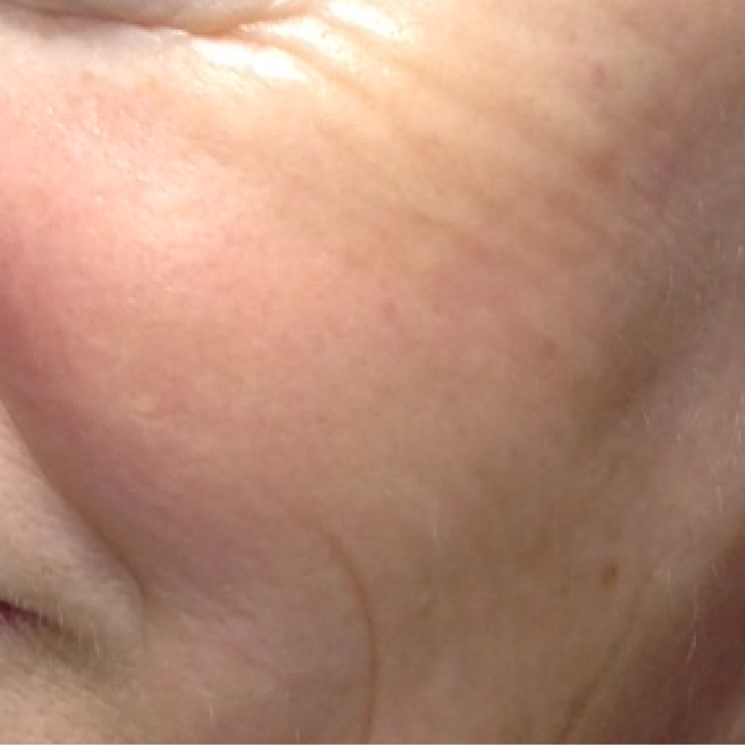 Close-up of a person's wrinkled skin.