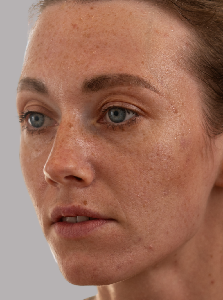 Pele Exposta à Poluição e Estresse