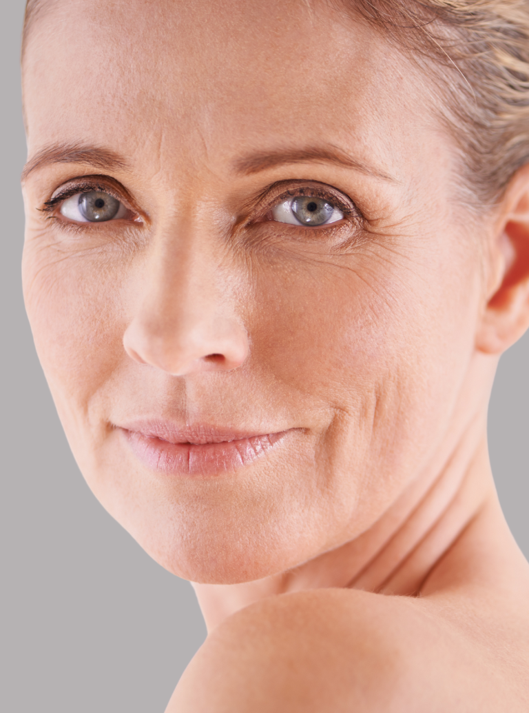 Pele Fina e Fragilizada