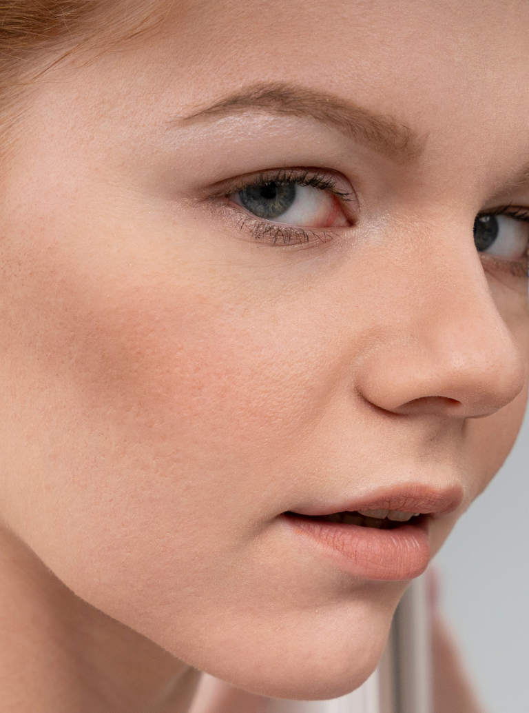 Pele Opaca e Sem Vida