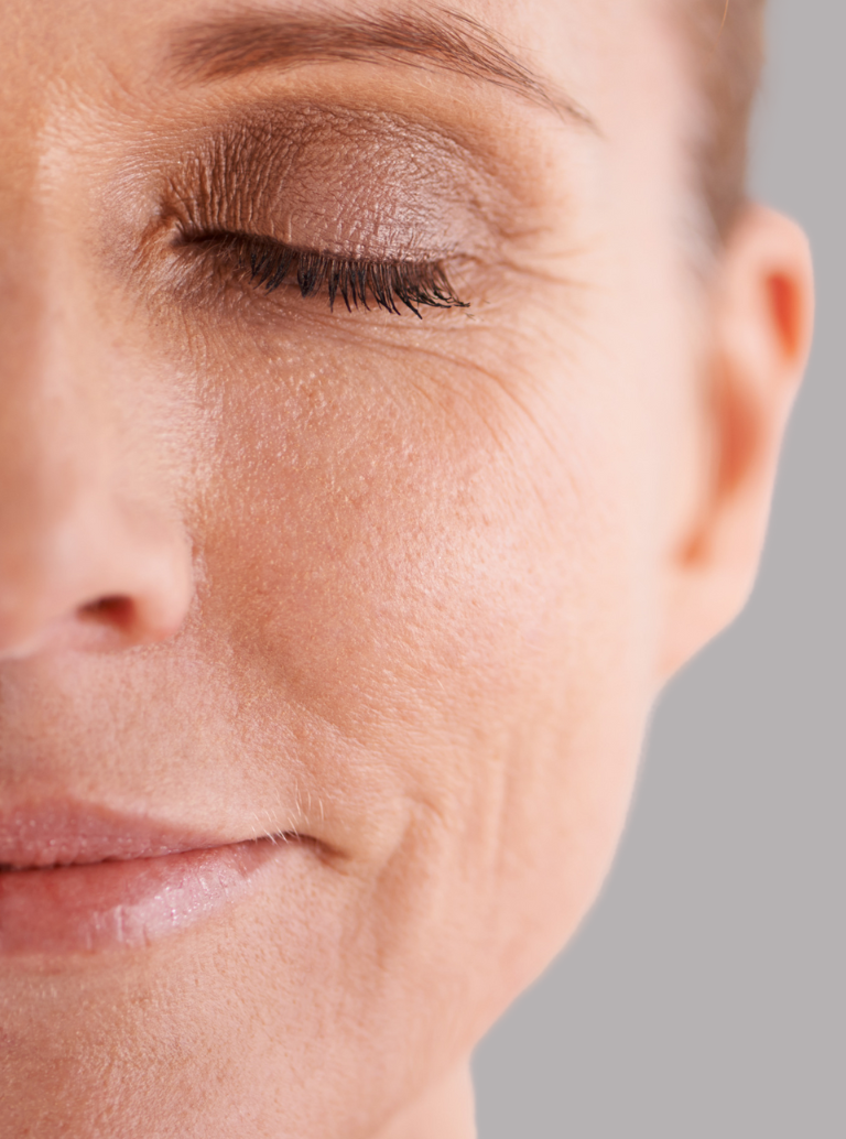 Pele Seca ou Desidratada