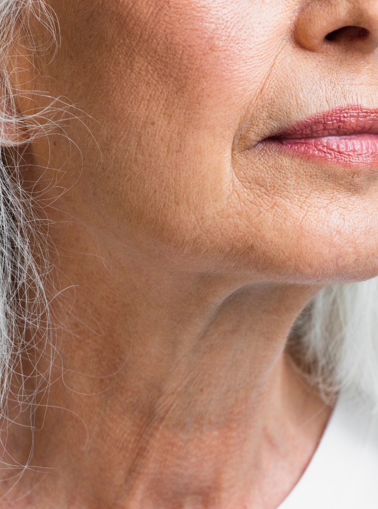 Perda de Densidade da Pele