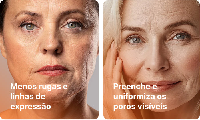 Como funciona a ciência por trás da BioSkin®